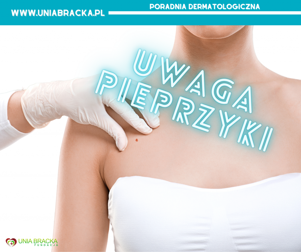 Kiedy badać znamiona?