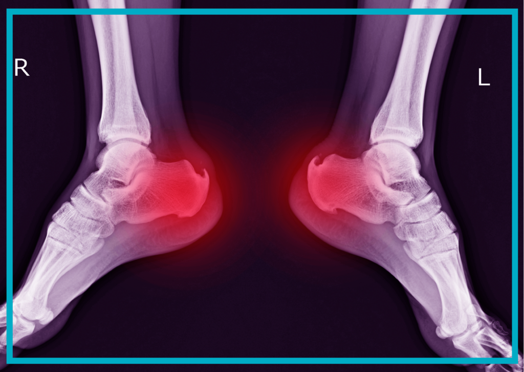 Fala uderzeniowa Śląsk