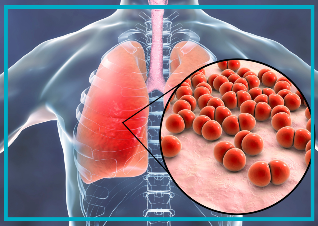 Szczepienie Fundacja "Unia Bracka"