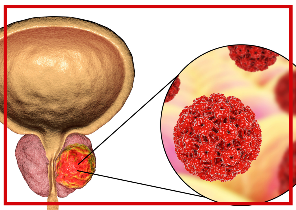 Szczepienie przeciw HPV