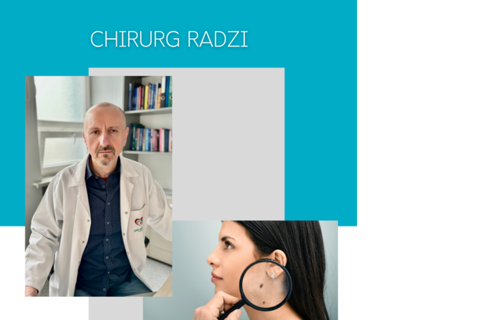 Pieprzyki, znamiona i piegi – chirurg radzi